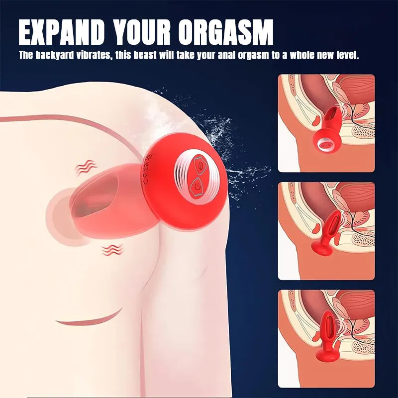 Remote_Control_Electric_Slap_Anal_Plug