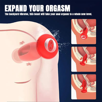 Remote_Control_Electric_Slap_Anal_Plug